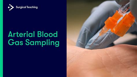 arterial blood gas sampling procedure